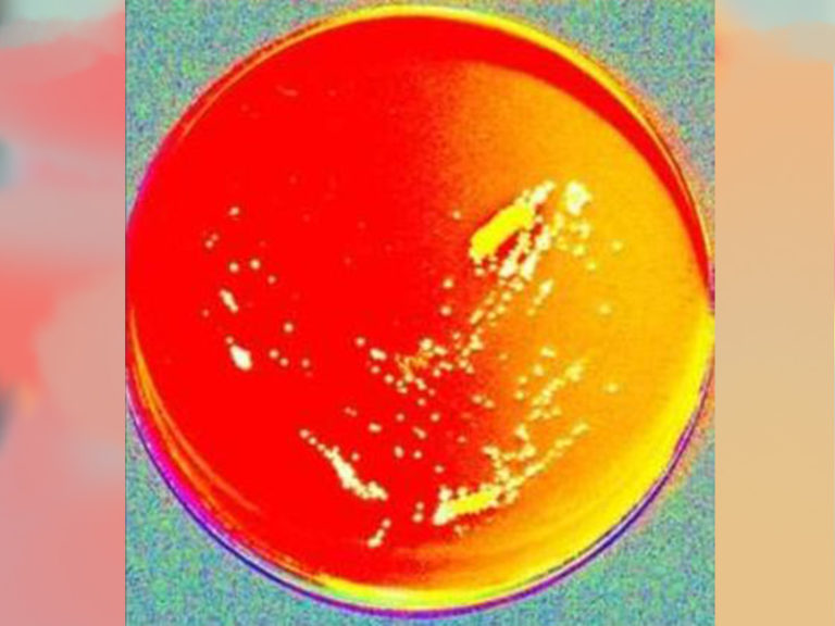 A photo of a petri dish